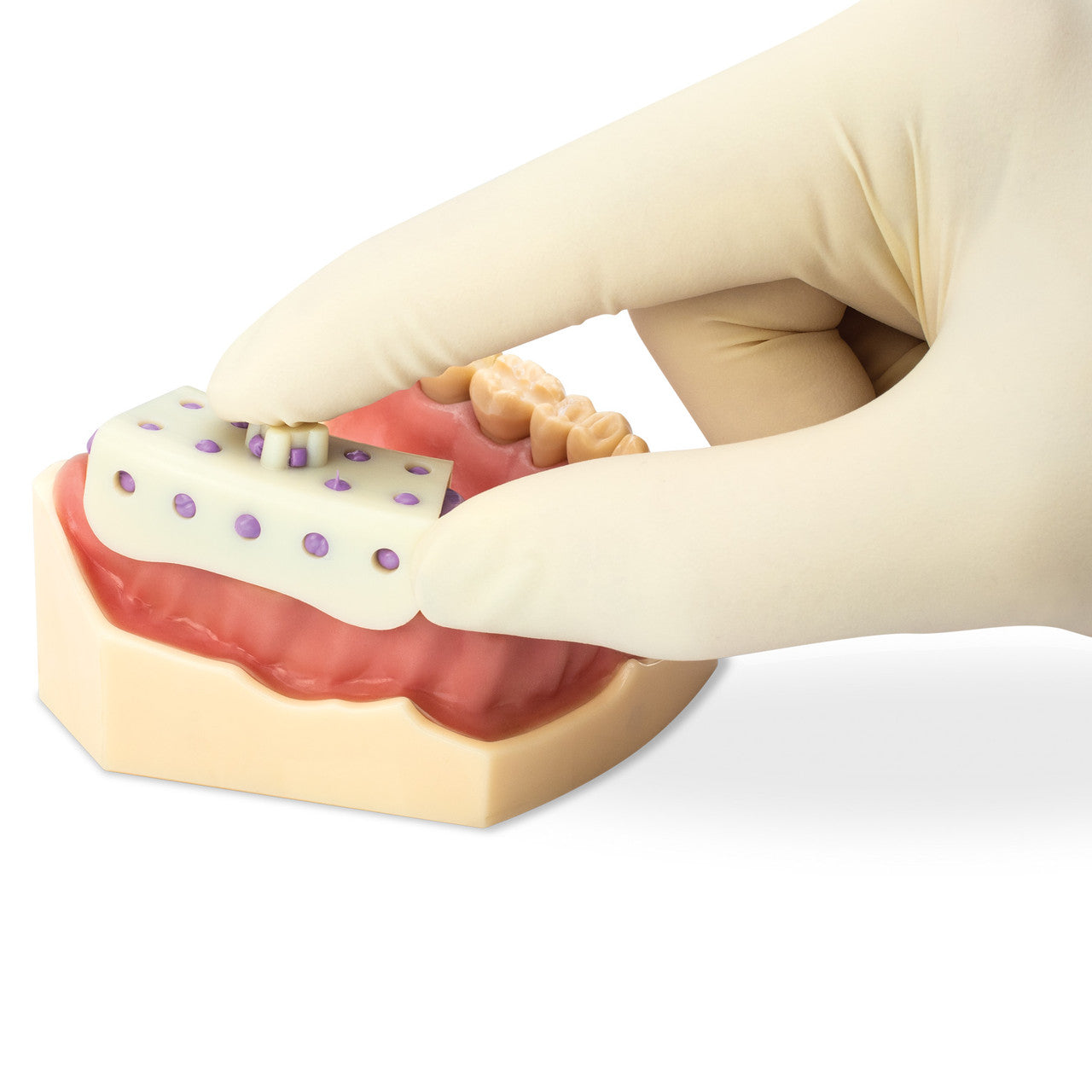 Practicon 11440 Micro-Tray Disposable Impression Trays Heat Moldable 50/Pk