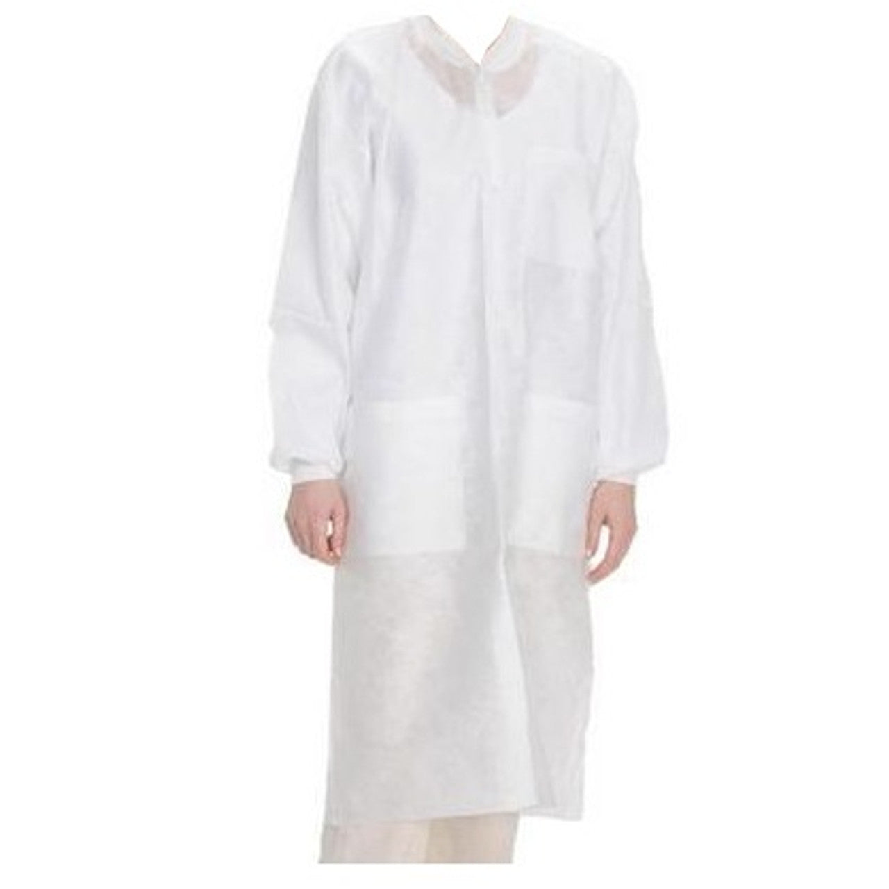 ValuMax 3560WHXL EasyBreathe Lab Coats White Extra Large 10/Pk