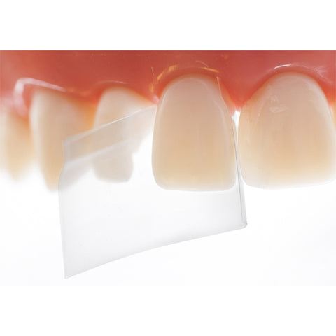 Directa 604092 ProxyPal 3D Anterior Universal Dental Matrix Bands 36/Pk