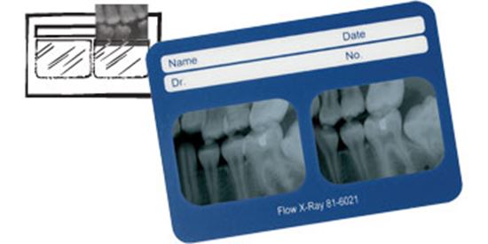 Flow X-Ray Corp 81-6180 Perfect Pocket X-Ray Mounts 100/Pk 18-6V