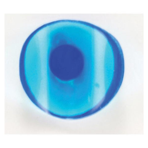 Garrison KCMA10 Blue View Cervical Matrices Transparent Blue Size #10 100/pk