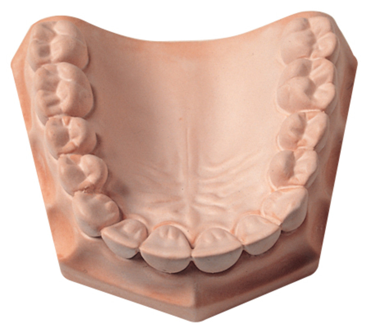 Whip-Mix 23690 Snap-Stone Dental Labstone Type IV Pink High Strength 11 Lb
