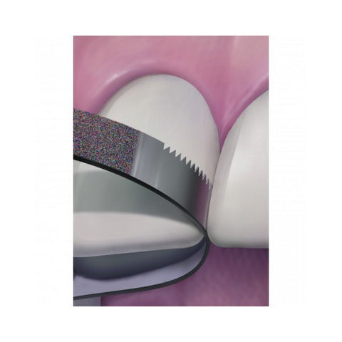 Axis Dental FS3-FX NTI Diamond Strips Fine Grit Serrated 3.75mm 10/Pk