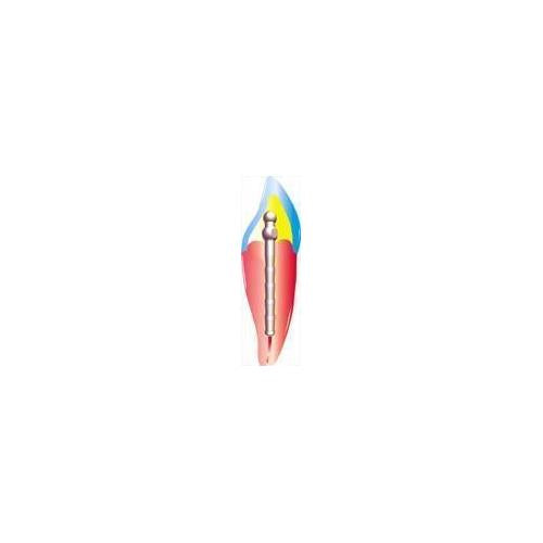 Coltene Whaledent PF161-5.5 ParaPost Fiber White Resin Esthetic Posts .055